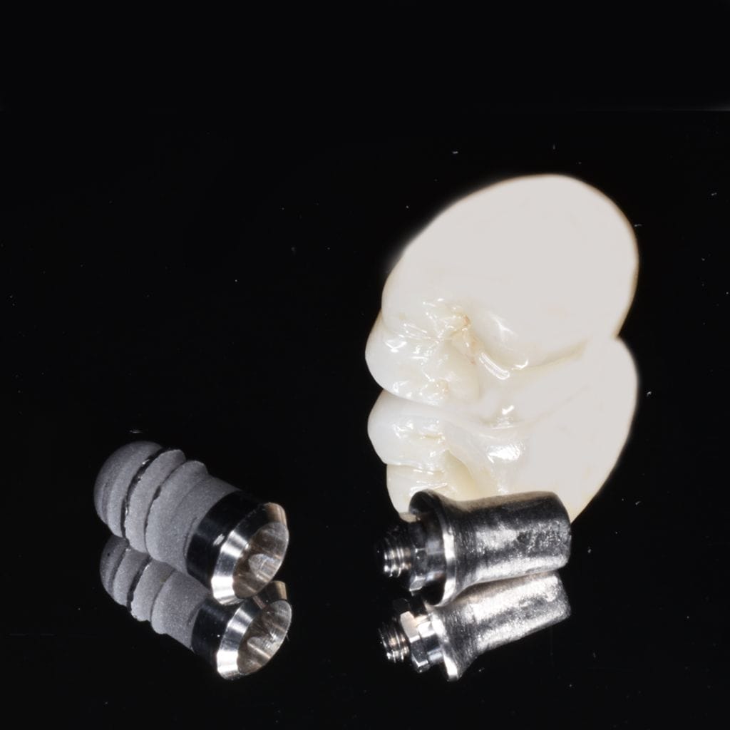 インプラントプレミアム|審美