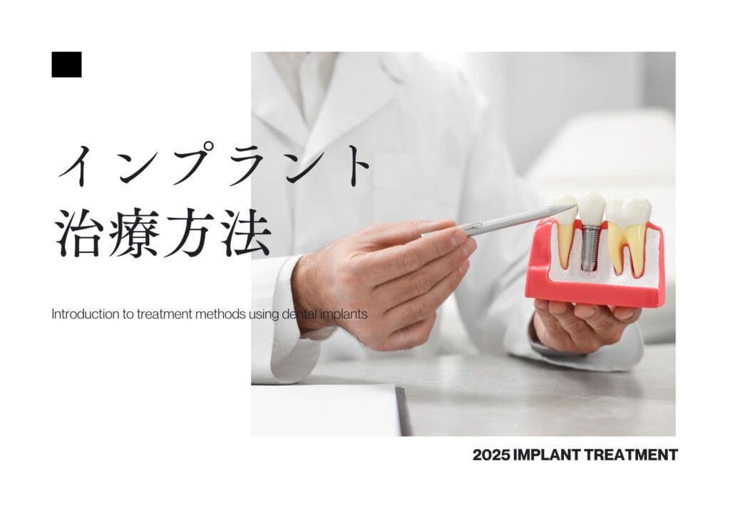 インプラント治療方法