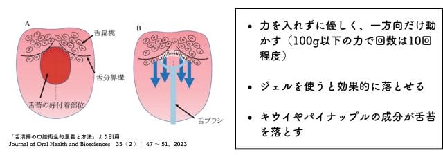 5 口臭ケア|自宅